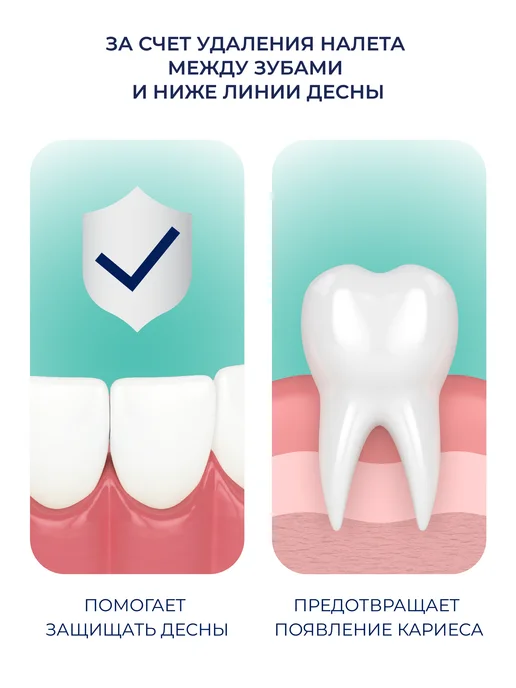 beiber Объемная зубная нить 30 м, 30 м, фото 4