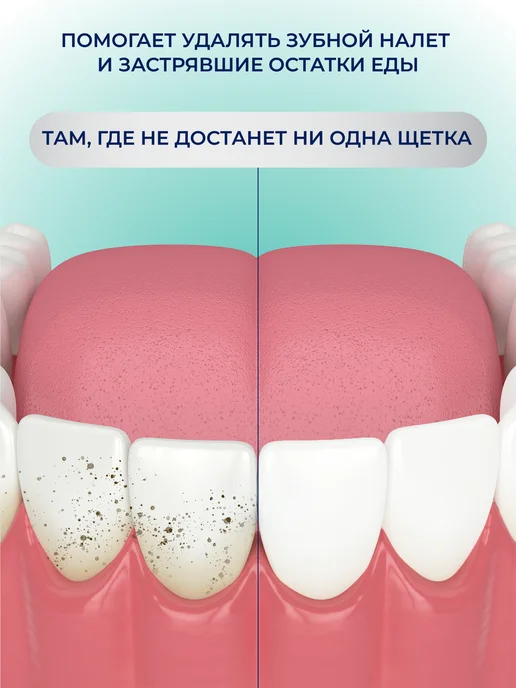 beiber Объемная зубная нить 30 м, 30 м, фото 6