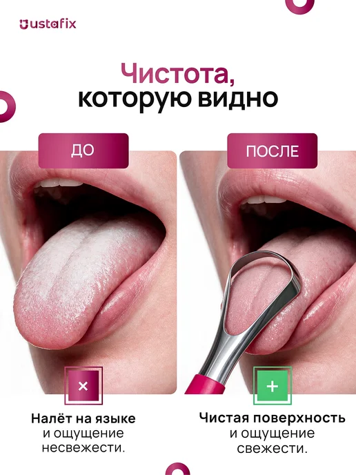 USTAFIX Скребок для языка 2 штуки набор, вариант, фото 2
