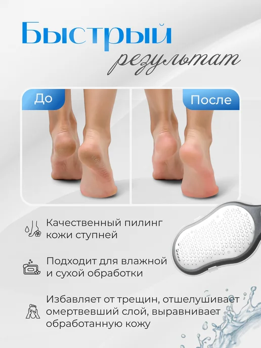Kavi Bellesa Терка для ног с контейнером педикюрная, черный, фото 2