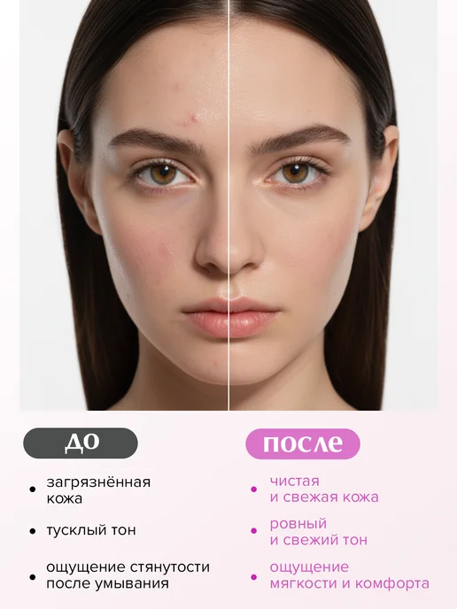 ARAVIA Laboratories Пенка-мусс для умывания с молочной кислотой для лица, 100 мл, фото 3