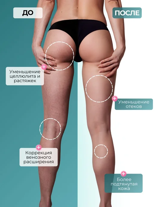 BBalance LYMPH Кинезио тейп для тела 7,5см*5м, голубой, 5 м, фото 3