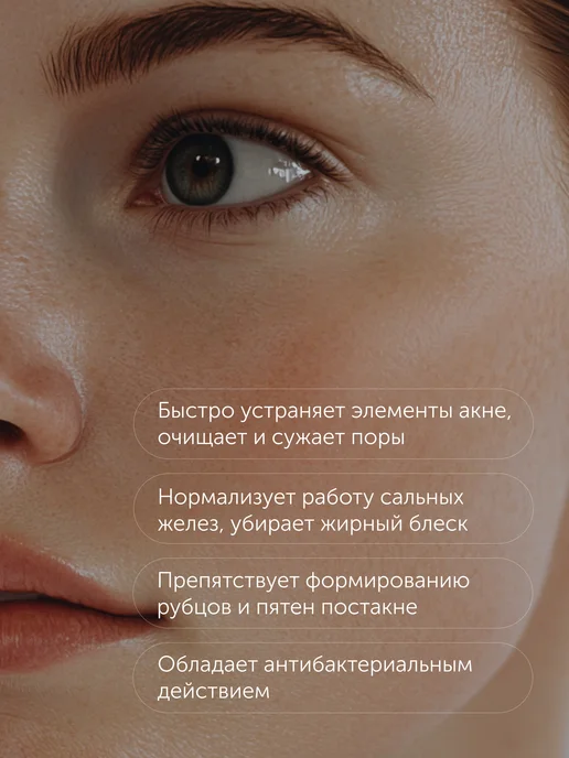 Mesaltera ANTI ACNE ACTIVE Лосьон для проблемной и жирной кожи, 195 мл, фото 2