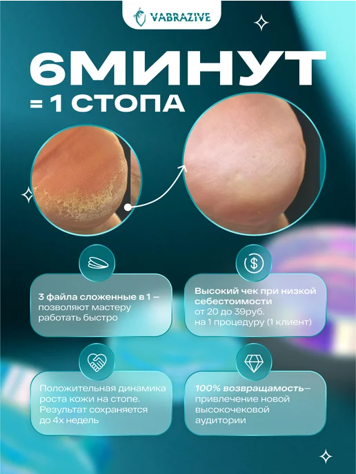 VABRAZIVE Набор сменных файлов на смарт диск для педикюра L, вариант, фото 7